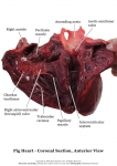Pig Heart_003