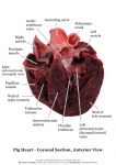 Pig Heart_007