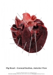 Pig Heart_008
