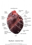 Pig Heart_011