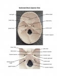 Sectioned Skull, Superior View (labeled)